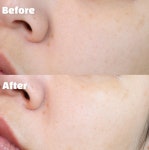 뷰앤뷰 피부과 재생 레이저 리페어 크림 30ml 1개 민감성, 복합성, 모든피부용 : 뷰앤뷰 베이비앤뷰
