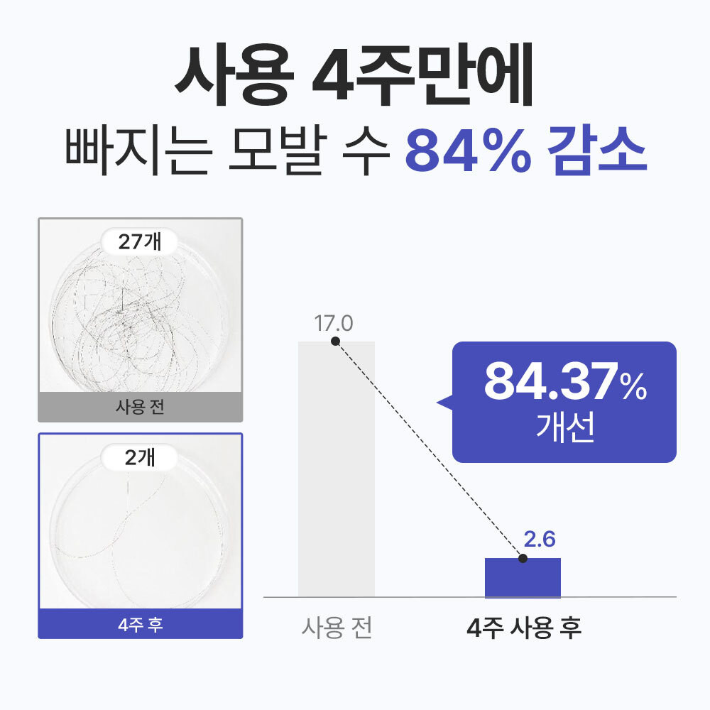 다양한 탈모 샴푸 제품 소개와 성분 분석