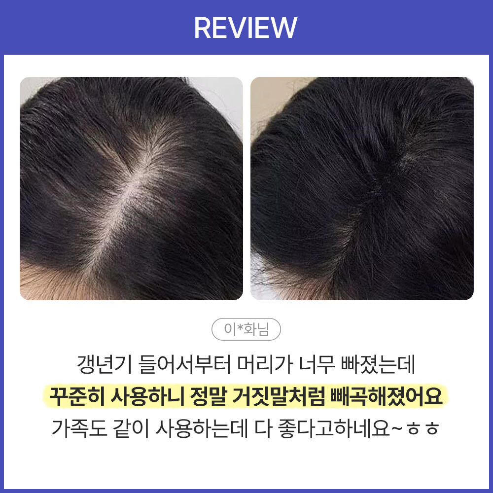 젊은 남성을 위한 효과적인 탈모 샴푸 소개