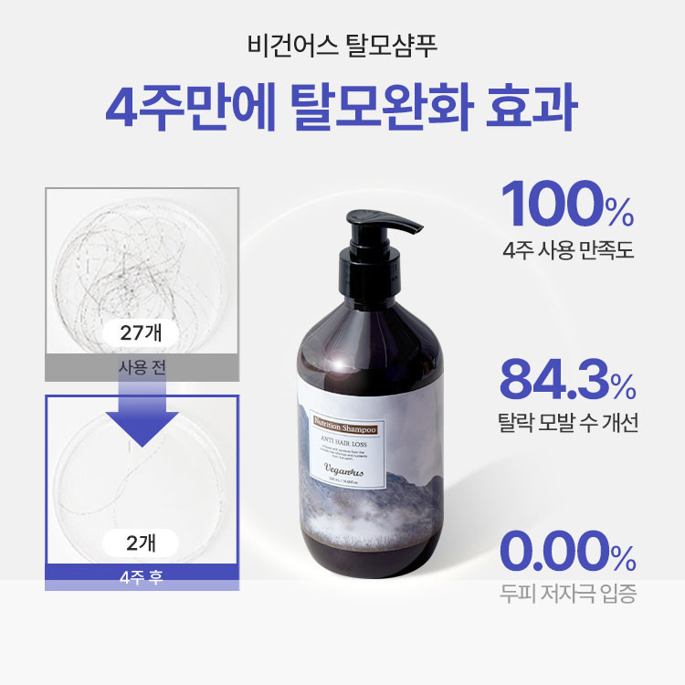 바이오틴남자탈모샴푸, 여성형과 남성형 탈모에 맞게 선택이 관건