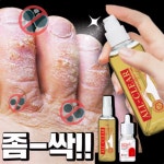 메디올가 문제성 손발톱 집중 완벽케어 2종세트 네일에센스+풋미스트 : 온더하기