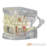 GPI USA 투명치아모형 치아 치주 질환포함 G2861 실제사이즈 : 의료기상사