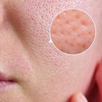 쿨티트리모델링팩 에스테틱 효과 소도구+팩 본품 6개입 : 벨라보테