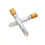 BD진공채혈관 Vacutainer SST II PLH tube 3.5mL 100개 367957 : 부림약품