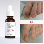 [약국입점] 베스토 블리아주 발톱 솔루션 영양제 강화제 1개 : bestoe