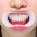 투더블유 치아미백 셀프 기계 화이트닝겔 자가 주사기형 미백젤 : 제이엔퍼시픽