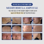 에스테인 메디포뮬러 앰플 50ml : 더웨이장유점