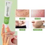 흉터밤루티너 멀티밤 모공밤 접주름 안면홍조 약국기미크림 연고 : cosmandy