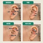 귀침 혈자리 귀 지압 점 패치 이침 이혈 테라피 스티커 : 아워스Ours