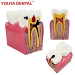 치과 의사 해부학 모델, 6 배 어금니 병리, 소통 교육 연구 : 샤메디컬