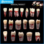 치과 치아 모델, 근관 블록, RCT 실습, 수지 엔도 훈련, 펄프 공동, 의사 교육 10 개 : 샤메디컬