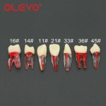 OLEVO 치과 근관 치료 RCT 실습 모델 펄프 파일 수지 치아 엔도 블록 연구 교육 M8007 : 샤메디컬