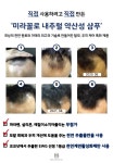 미라꼴로 약산성 탈모, 두피케어, 모발케어 샴푸 500ml : 주식회사 비엠에스임페리얼