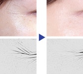 엠디레비스 펩타이드 콜라겐 세럼 30ml 미국직배송 : 로라베이