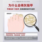 풋케어 홈케어손반톱 네일 발톱 레이저 손반톱 램프 발 휴대용 건조기 홈케어광선 요법 : 비욘드웨이브