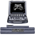 SonoSite M-Turbo P17000-13 Titan MicroMaxx Ultrasonic 용 배터리 P07168 : 북한강인터네셔널