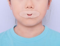 달숨 숙면보조밴드 숙면보조테이프 60매 일벌림 방지 테이프 성인용 어린이용 코골이 이갈이 : 달숨스토어