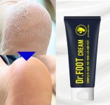 발 각질 연화제 뒤꿈치 갈라짐 굳은살 연고 바하 크림 복숭아뼈 바닥 각화 보습 냄새 약국 : 방금 마켓