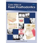 고정 보철물의 컬러 아틀라스 : 위스프웨이