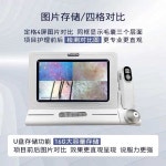 두피확대기 고화질측정기 탈모관리 모발 피부진단 200배 단일 스펙트럼(이미지 고정/저장 불가 : 더포인트스토어