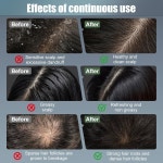 모발 성장 빗, 모발 성장을 위한 레드 라이트 테라피, 두꺼운 두피 마사지기 화이트. : 온슈어라이프