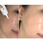 디에스 시카멜라 리페어크림 레이저후 점뺀후 관리 트러블 케어 20ml, 1개 : 에이트뷰티