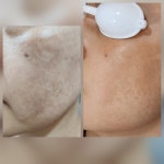 주&이채현피부관리실 | 익산 피부관리 웨딩관리 윤곽 탄력 색소관리추천 : 이채윤에스테틱