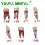 5pcs 치과 치아 근관 치료 교육 연구 모델 블록 실습 펄프 캐비티 엔도 RCT 훈련 : 샤메디컬