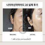 인셀덤아이미 | 나이아신 아마이드 20% 앰플 니아신아마이드 고함량 세럼 에센스 NIACINAMIDE : 비누원 공식몰