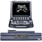 Cameronsino SonoSite 배터리 P07168  MicroMaxx  M-Turbo  P17000-13  Titan 용 : 미주스포
