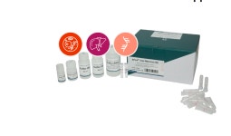 APure™ Total RNA mini (동물 세포, 조직 등으로부터 Total RNA 추출) H3105(50) : 바이오메이트랩