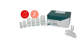APure™ Blood RNA mini (전혈에서 RBC 제거후 WBC에서 total RNA 추출) H3425 (250) : 바이오메이트랩
