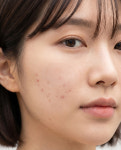 패치큐 화이트벨라 스팟 마이크로 다트 패치 12매입 : 주식회사 패치큐