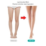 어린이용 다리 고정 교정기 후크 통풍 벨트 다리형 교정 루프 탄성 밴드 : 애플 주스