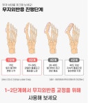 얇은 무지외반 휜 발가락 교정기 밴드 탄력 의료용 병원 약국 : 도토리메디팜