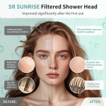 SR SUN RISE 필터 샤워 헤드 - 고압 레인 샤워 헤드, 20단계 샤워 필터, 1.8 / 2.5 GPM 유량, 경 연제용 6가지 모드, 염소 제거(크롬, 5.5 인치)... 