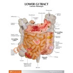 -GPI Anatomicals 인체모형 위장관 소화관 GI Tract G3342 : 종로상사