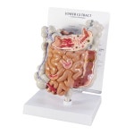 -GPI Anatomicals 인체모형 위장관 소화관 GI Tract G3342 : 종로상사