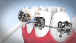 팝테크 오랄픽 SD101-P