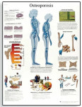 골다공증 차트 Osteoporosis Chart 인체해부도 VR1121L