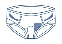 파비스 656 탈장대 순면 서혜부 탈장 방지 의료기기