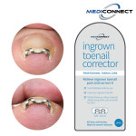 메디커넥트 ingrown toenail corrector 2개