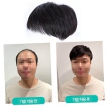남자가발 남자가발 정수리 커버 풍성한 앞머리 미용 장발
