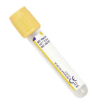 BD 진공채혈관 Vacutainer SST II PLH tube 3 100개 튜브 시험관 367957