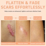 2PCS 흉터 솔루션 실리콘 스틱 얼굴과 몸을 위한 60 실리콘 스틱 어플리케이터 수동 마사지 적합 모든 피부 타입에 순한 제품