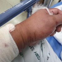 김포 아파트 복도 천장서 조명등 유리 떨어져…40대 중상