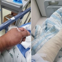 “동맥·신경 다 끊겼는데 책임 못진다고”…아파트 엘베 기다리다 날벼...