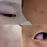 ‘청라 전기차 화재’ 그 아파트 돌아왔더니…“눈이 빨개요” 주민 고...