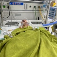 20대 운전자, 60대 경비원 넘어뜨려 ‘뇌사’…아파트 차량 진입 시비가...