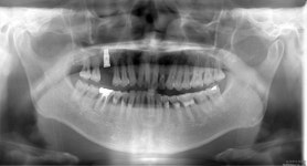 해오름치과의원